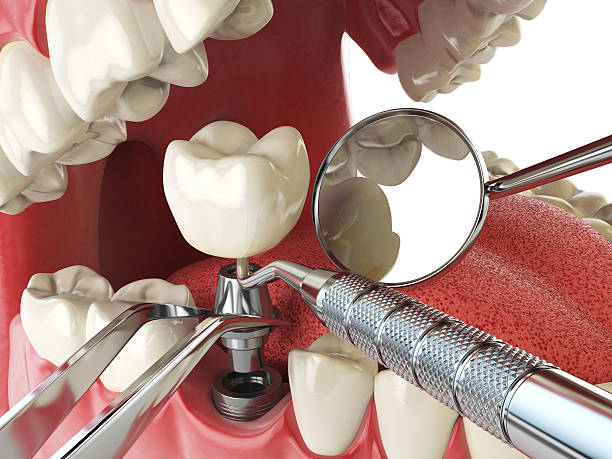 Best Broken or Cracked Tooth Emergency Dentist in Laurel Bay, SC